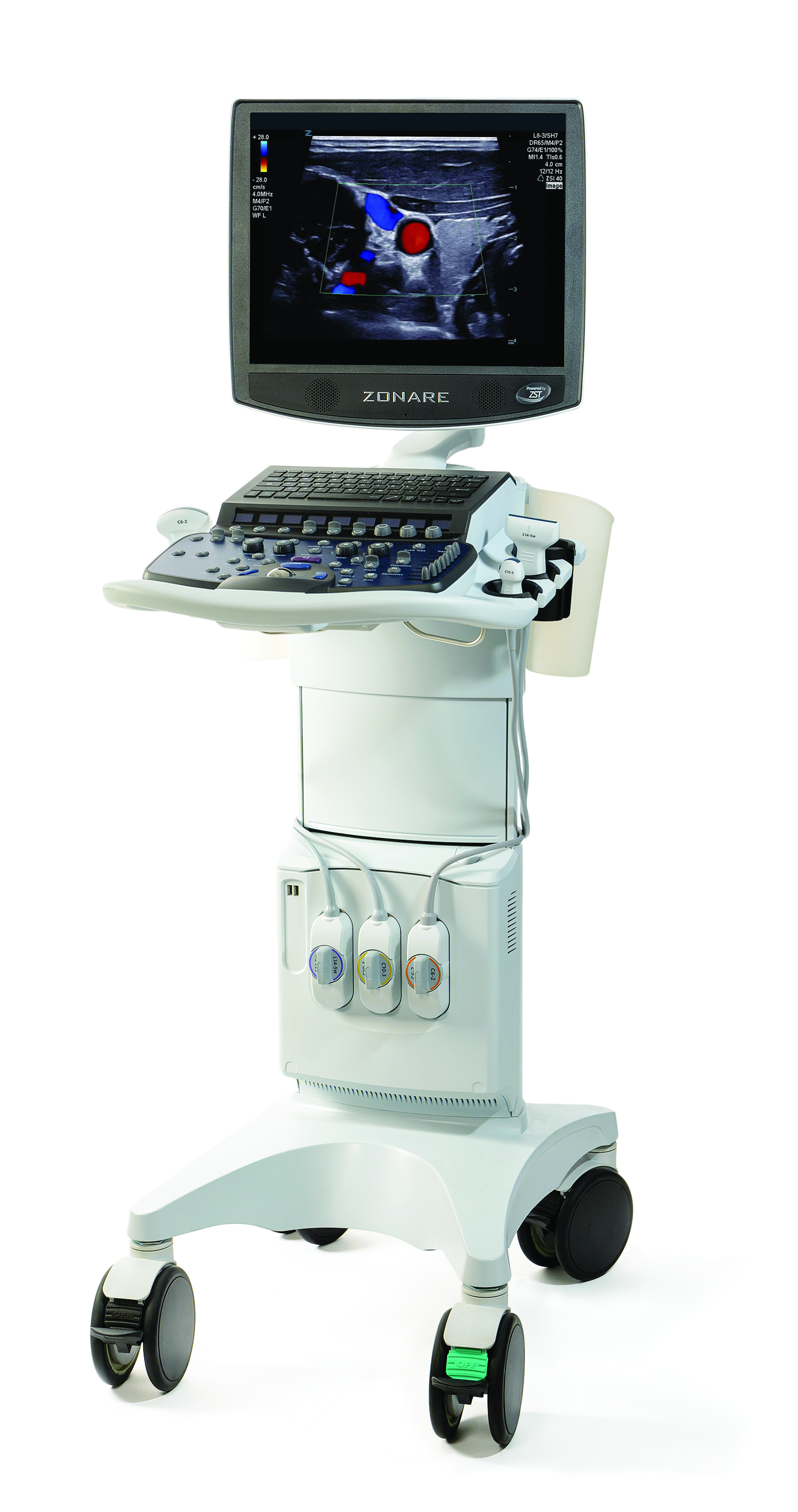 Zonare Releases Upgrade for its ZS3 Ultrasound System | Imaging 